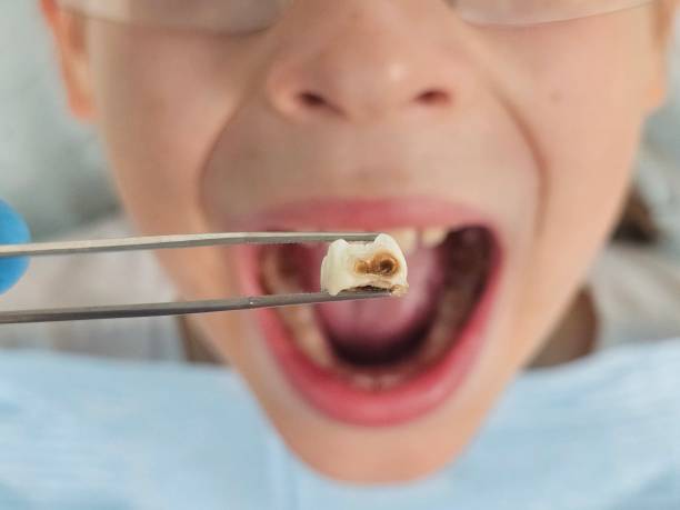 Best Emergency Treatment for Toothache in Conyngham, PA